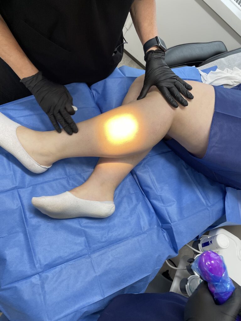 Understanding Leg Vein Problems  Vein Specialist & Treatment in